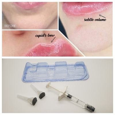 1 мл Juvederm Medical Натриевый гиалуронат гель Гиалуроновая кислота гель для инъекций для носового моста