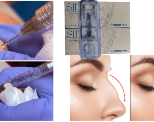 Инъекция гиалуроновой кислоты для лица и губы Dermal Filler Ce MSDS ISO