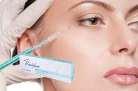 Губы щеки Гиалуроновая кислота Dermal Filler Refyne Defyne Silk Lyft