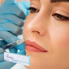 Гиалуроновая кислота Инъекционное Dermal Filler Инъекционный гель для губ
