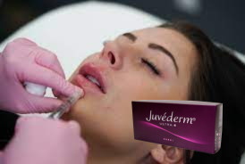Женский скрещенный гиалуроновой кислотой Dermal Filler Juvederm Lip Filler Ultra 3 Ultra 4