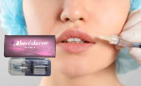 Juvederm Ultra3 Гиалуроновая кислота Dermal Filler Cross Linked HA Filler CE GMP