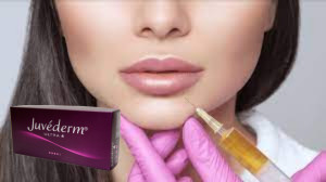 Juvederm Ultra 3 Гиалуроновая кислота HA Dermal Filler 2 мл Увеличение губ