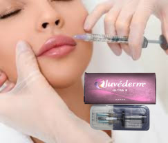 2 X 1 мл Juvederm Ultra 4 Инъекционное дермальное наполнитель Наполнитель для губ