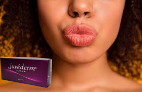 Juvederm Ultra 3 Гиалуроновая кислота HA Dermal Filler 2 мл Увеличение губ